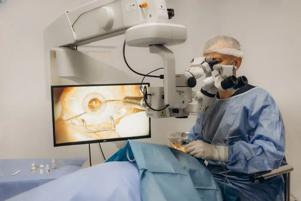 traditional cataract surgery